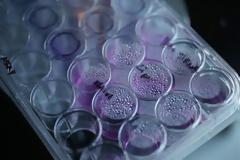 Υγεία: Κλωνοποίησαν ανθρώπινα βλαστοκύτταρα