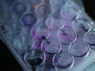 Φωτογραφία για Υγεία: Κλωνοποίησαν ανθρώπινα βλαστοκύτταρα