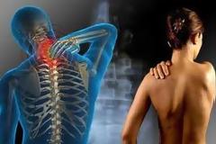 Υγεία: Ινομυαλγία - Μια συνήθης και επικίνδυνη μυοσκελετική πάθηση!