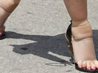 Φωτογραφία για Tα πρησμένα πόδια που η Κιμ Καρντάσιαν προσπαθεί να σφηνώσει σε ψηλοτάκουνα