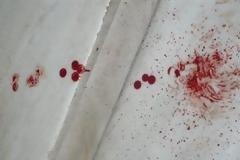 Πάτρα: Tο ποτό 