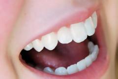 Γυναίκα δάγκωσε αστυνομικό