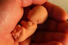 Πως εξαφανίζεται ένας λαός