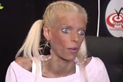 Nανά Καραγιάννη: Πρώτο θέμα στην Τουρκία! - Αφιέρωμα στη μάχη της με την ανορεξία