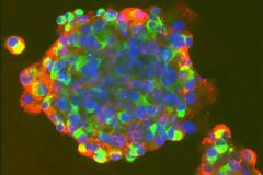 Επιστήμονες δημιούργησαν ανθρώπινα βλαστοκύτταρα μέσω κλωνοποίησης