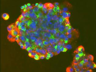 Φωτογραφία για Επιστήμονες δημιούργησαν ανθρώπινα βλαστοκύτταρα μέσω κλωνοποίησης