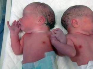 Φωτογραφία για Η πιο συγκινητική φωτογραφία: Δυο αδερφάκια γεννήθηκαν χέρι-χέρι!