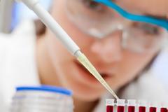 Υγεία: Το ουρικό οξύ απειλεί την καρδιά