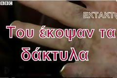 Με τα ΕΛΤΑ στα Γιάννενα κομμένα δάκτυλα!