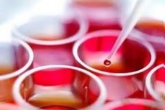 'Η πληρωμή που ακόμη δεν ήρθε'