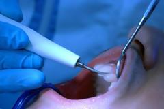 Πάτρα: Oδοντίατρος κάνει εξαγωγές για ψύλλου πήδημα! - Γνωστός Πατρινός του έκανε μήνυση