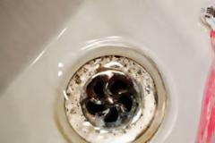 Οι 5 σοβαρότατοι κίνδυνοι που ενέχει η αποτρίχωση των γεννητικών οργάνων