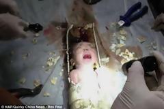 Έσωσαν βρέφος που είχαν πετάξει σε σωλήνα αποχέτευσης!