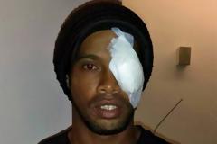 ΦΩΤΟ-Ο «μονόφθαλμος» Ροναλντίνιο