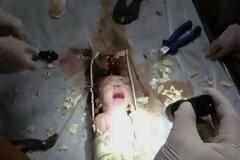 Συγκλονιστικές εξελίξεις: Βρέθηκε η μητέρα που πέταξε το μωρό στον σωλήνα αποχέτευσης!