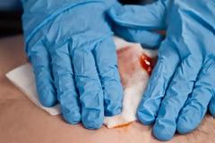 Kαι όμως! Αυτό το αστείο πλάσμα μπορεί να προκαλέσει θανάσιμη αιμορραγία