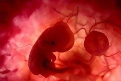 Απαγόρευτηκε άμβλωση σε άρρωστη γυναίκα