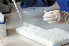 Υγεία: Θετικές ενδείξεις για θεραπεία εγκεφαλικών με βλαστοκύτταρα