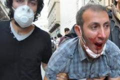 Συγκλονιστική φωτογραφία: Tούρκος αστυνομικός κλωτσάει στο κεφάλι πεσμένο γυμνό διαδηλωτή