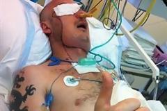 ΣΥΓΚΛΟΝΙΣΤΙΚΟ VIDEO: Η πρώτη μεταμόσχευση προσώπου στην Πολωνία