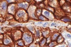 Υγεία: Έγκαιρη διάγνωση, 