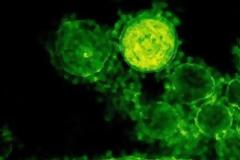 Ήρθε στην Ευρώπη ο θανατηφόρος κορονοϊός - Oδηγίες και επαγρύπνηση από το ΚΕΕΛΠΝΟ