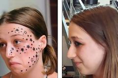 Μετάνιωσε για τα 56 τατουάζ