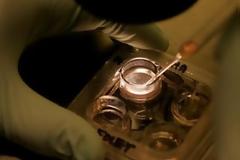 Υγεία: Αναγέννηση οστών με μια ένεση