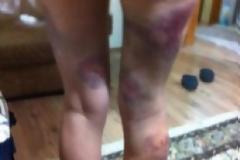 17:07Σοκάρουν οι φωτογραφίες της Τουρκάλας διαδηλώτριας που χτύπησαν
άσχημα αστυνομικοί !