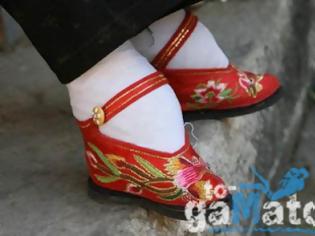 Φωτογραφία για Σοκαριστικές εικόνες: Δείτε πως κάνουν τα πόδια τους οι Κινέζες για να δείξουν πως ανήκουν σε υψηλή κοινωνική τάξη
