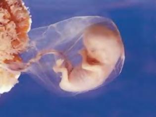 Φωτογραφία για Τα έμβρυα αυνανίζονται - Σάλο προκαλεί η δήλωση γνωστού πολιτικού