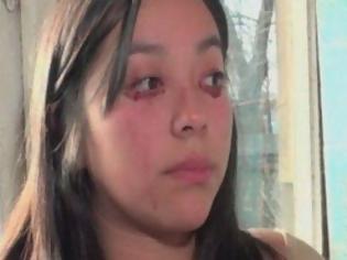 Φωτογραφία για 20χρονη αντί για δάκρυα βγάζει αίμα [Video]