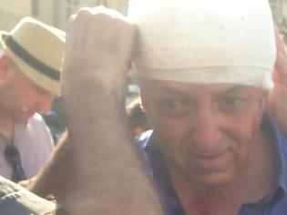Φωτογραφία για O ανταποκριτής του BBC στην Αίγυπτο που τραυματίστηκε στο κεφάλι από
τους πυροβολισμούς και συνέχισε το ρεπορτάζ