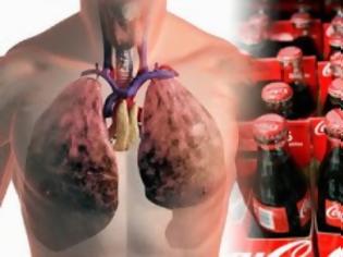 Φωτογραφία για ΣΟΚ: Εθισμένος στην coca cola, πέθανε με πρησμένα πνευμόνια 4 φορές περισσότερο από το κανονικό!