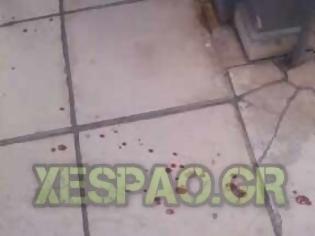 Φωτογραφία για Πάτρα: Άγρια συμπλοκή στα Zαρουχλέικα - Έπεσαν μαχαιριές - Ένας σοβαρά τραυματίας - Δείτε φωτο