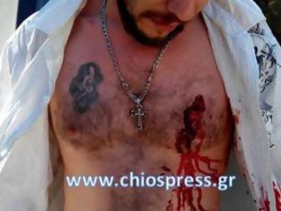 Φωτογραφία για Xϊος: Σοκαριστική φωτογραφία από την απόπειρα δολοφονίας σε βάρος 34χρονου - Ελεύθεροι οι φερόμενοι ως δράστες!