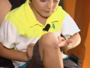 Φωτογραφία για Απίστευτο: Θαλάσσιο σαλιγκάρι εκκολάφθηκε στο γόνατο 4χρονου αγοριού [video]