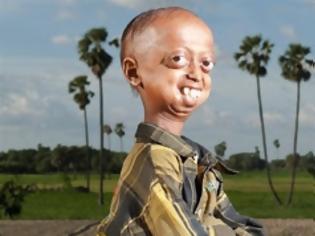 Φωτογραφία για Ινδία: 14χρονος ζει στο σώμα ανθρώπου 110 ετών