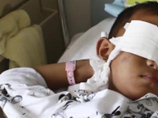 Φωτογραφία για Ποιός έβγαλε τα μάτια του μικρού Γκουό; H αστυνομία δεν πιστεύει πια το σενάριο της εμπορίας οργάνων