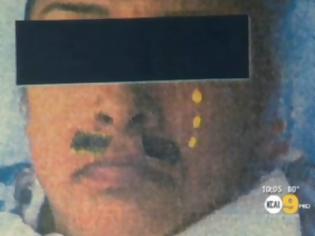 Φωτογραφία για Γιατροί εξευτέλισαν ασθενή ζωγραφίζοντάς της το πρόσωπο