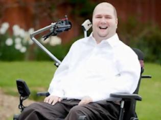 Φωτογραφία για Barry West : O ανάπηρος που συγκλονίζει ! (pics)
