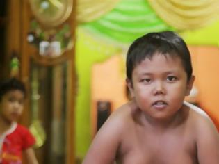 Φωτογραφία για Ινδονησία: Το παιδί που κάπνιζε έκοψε το τσιγάρο!