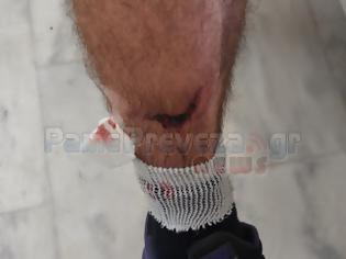 Φωτογραφία για Στο νοσοκομείο από επίθεση σκύλων στην Πρέβεζα στο Μονολίθι