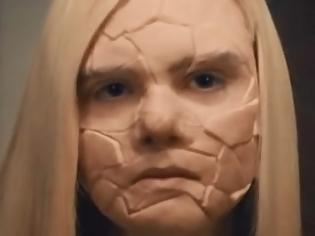 Φωτογραφία για Ο τρόμος της βουλιμίας: Ένα συγκλονιστικό video που θα προκαλέσει