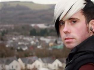 Φωτογραφία για Έγινε ομοφυλόφιλος ύστερα από εγκεφαλικό