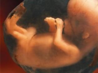 Φωτογραφία για Τα έμβρυα πιθανόν να αναγνωριστούν ως... άνθρωποι
