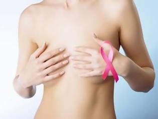 Φωτογραφία για Καρκίνος μαστού: Δέκα διαφορετικές ασθένειες