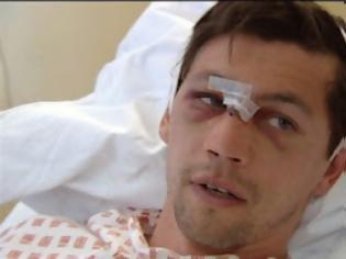 Φωτογραφία για Απίστευτος τραυματισμός ποδοσφαιριστή ( Video )