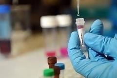 Συνελήφθη μικροβιολόγος που δεν επέτρεπε στην Αστυνομία τον έλεγχο των βιβλίων της