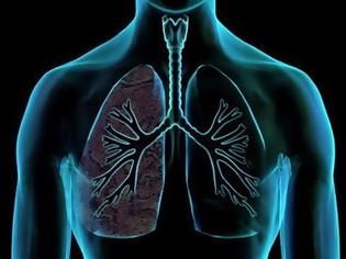 Φωτογραφία για 9 «ίχνη» που προμηνύουν καρκίνο του πνεύμονα